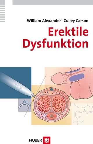 Erektile Dysfunktion