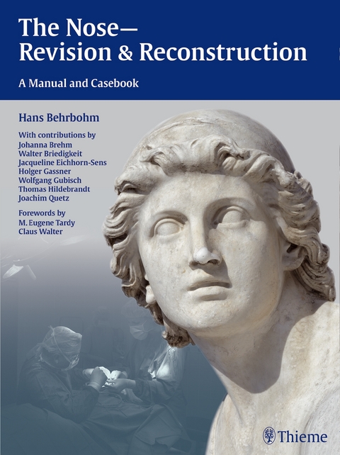 The Nose - Revision and Reconstruction - Hans Behrbohm, Jacqueline Eichhorn-Sens, Joachim Ulrich Quetz