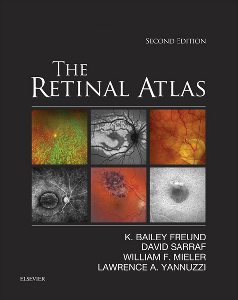 Retinal Atlas E-Book -  K. Bailey Freund,  William F. Mieler,  David Sarraf,  Lawrence A. Yannuzzi