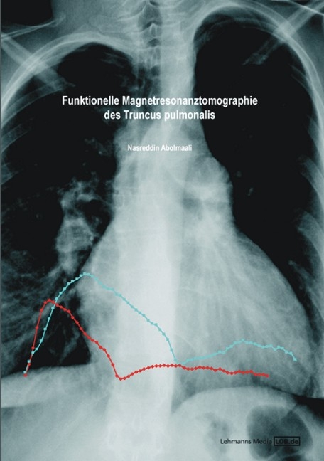 Funktionelle Magnetresonanztomographie des Truncus pulmonalis - Nasreddin Abolmaali
