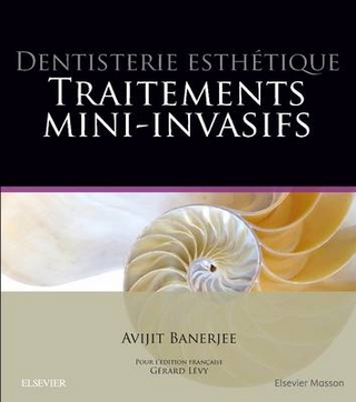 Dentisterie esthétique : traitements mini-invasifs