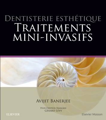 Dentisterie esth&eacute;tique : traitements mini-invasifs -  Banerjee