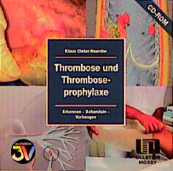 Thrombose und Thromboseprophylaxe, 1 CD-ROM