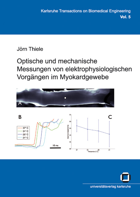 Optische und mechanische Messungen von elektrophysiologischen Vorg&auml;ngen im Myokardgewebe - J&ouml;rn Thiele