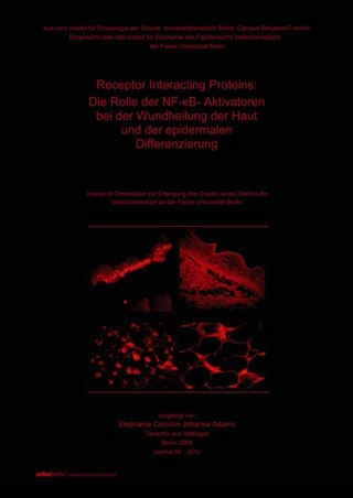 Receptor Interacting Proteins : Die Rolle der NF-(kappa)B-Aktivatoren bei der Wundheilung der Haut und der epidermalen Differenzierung