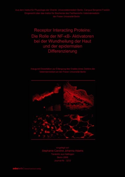 Receptor Interacting Proteins : Die Rolle der NF-(kappa)B-Aktivatoren bei der Wundheilung der Haut und der epidermalen Differenzierung - Stephanie Adams