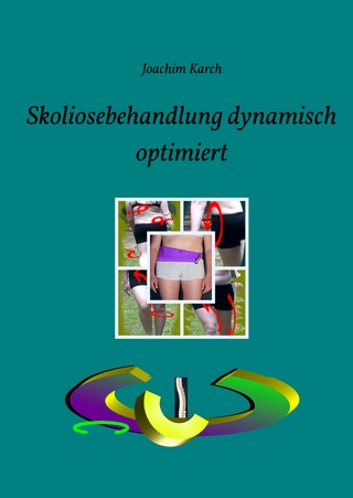 Skoliosebehandlung dynamisch optimiert