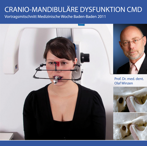 Craniomandibul&auml;re Dysfunktion-CMD - 