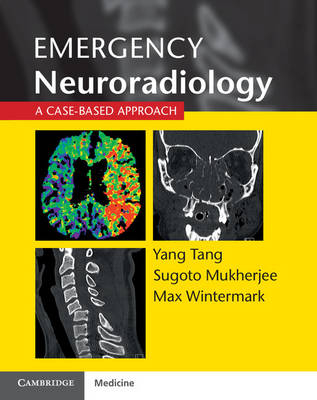Emergency Neuroradiology - 