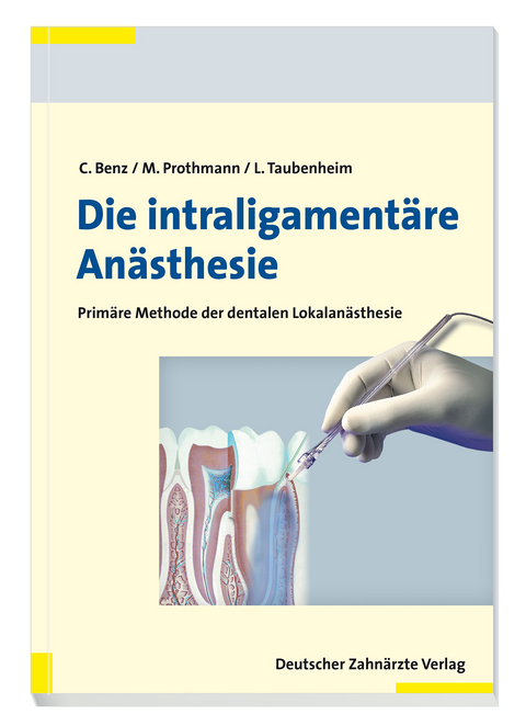 Die intraligament&auml;re An&auml;sthesie - Christoph Benz, Marc Prothmann, Lothar Taubenheim