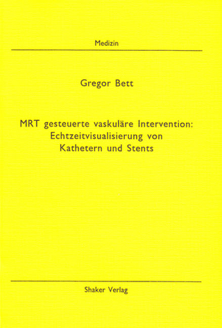 MRT gesteuerte vaskuläre Intervention: Echtzeitvisualisierung von Kathetern und Stents