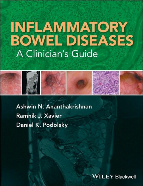 Inflammatory Bowel Diseases - Ashwin N. Ananthakrishnan, Ramnik J. Xavier, Daniel K. Podolsky
