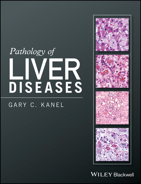 Pathology of Liver Diseases - Gary C. Kanel
