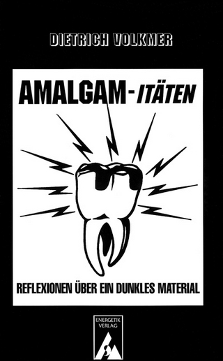 Amalgam-itäten