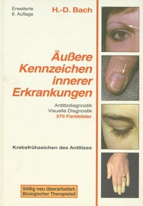 Antlitzdiagnostik / &Auml;ussere Kennzeichen innerer Erkrankungen - Hans D Bach