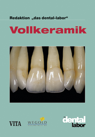 Vollkeramik