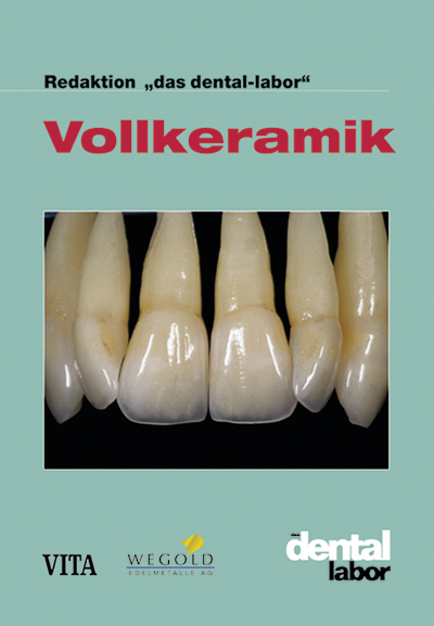 Vollkeramik - 