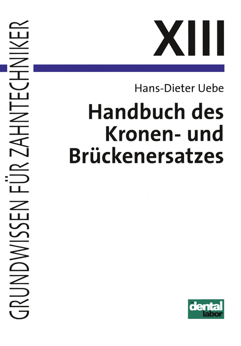 Handbuch des Kronen- und Br&uuml;ckenersatzes - Hans D Uebe