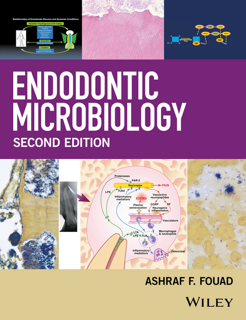 Endodontic Microbiology - 