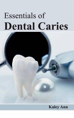Essentials of Dental Caries - 