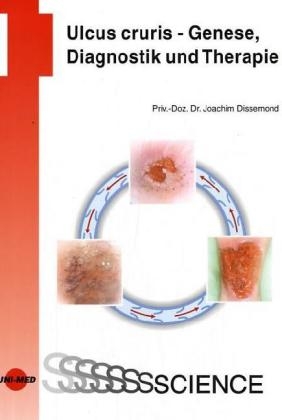 Ulcus cruris - Genese, Diagnostik und Therapie - 