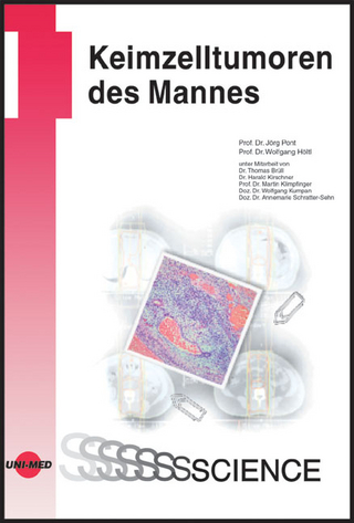 Keimzelltumoren des Mannes