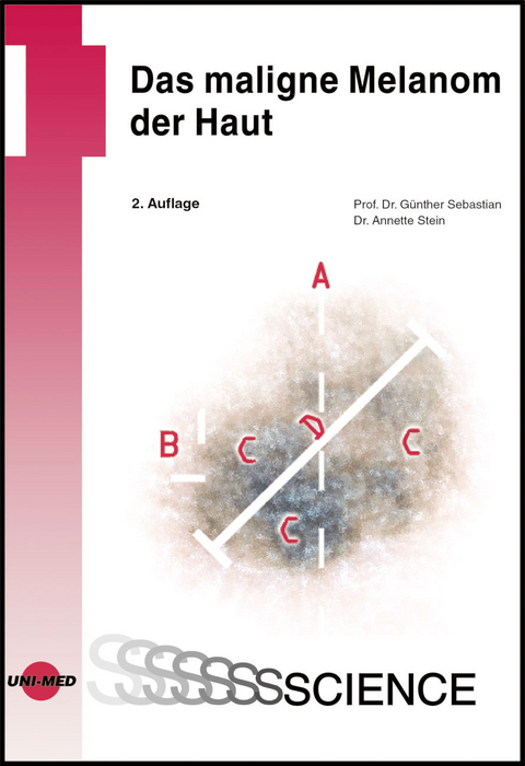 Das Maligne Melanom der Haut - G&uuml;nther Sebastian, Annette Stein