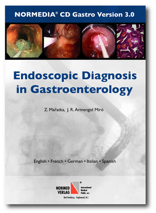 Endoscopic Diagnosis in Gastroenterology