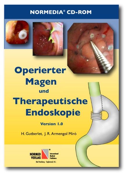 Operierter Magen und Therapeutische Endoskopie - Josip R Armengol-Miró, Harald Gutberlet