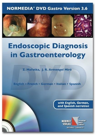 Endoscopic Diagnosis in Gastroenterology