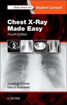 Chest X-Ray Made Easy - Jonathan Corne, Maruti Kumaran