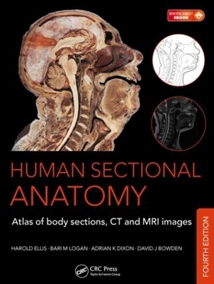 Human Sectional Anatomy - Bari M Logan, Harold Ellis, Adrian K Dixon, David J Bowden