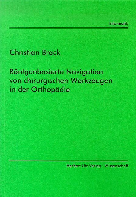 R&ouml;ntgenbasierte Navigation von chirurgischen Werkzeugen in der Orthop&auml;die - Christian Brack