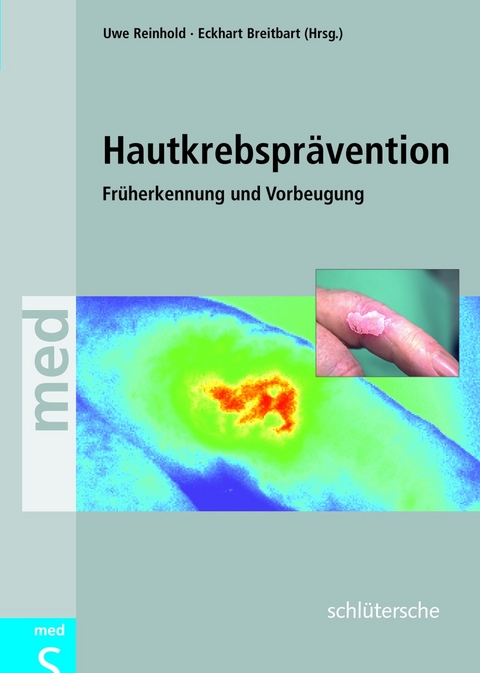 Hautkrebspr&auml;vention - Uwe Reinhold
