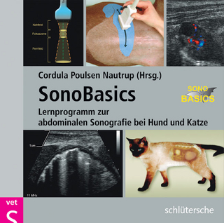 SonoBasics