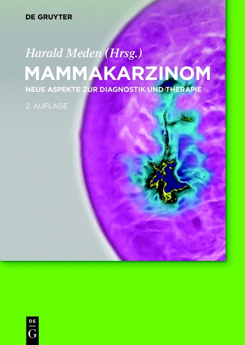 Mammakarzinom - 