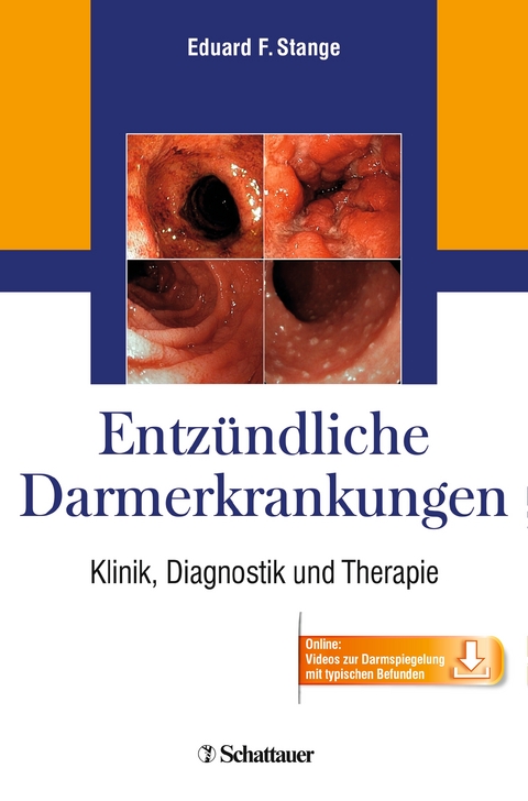 Entz&uuml;ndliche Darmerkrankungen - 