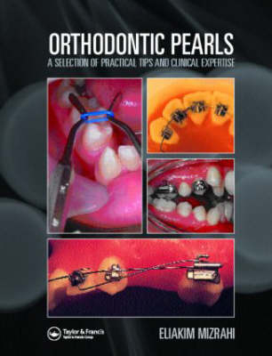 Orthodontic Pearls - 