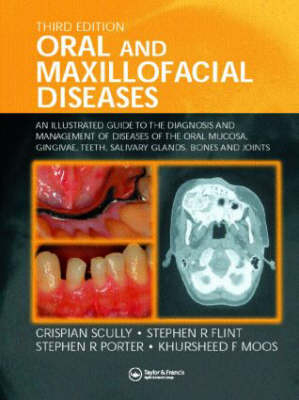 Oral and Maxillofacial Diseases - Crispian Scully, Stephen R. Flint, Stephen R. Porter, Kursheed F. Moos