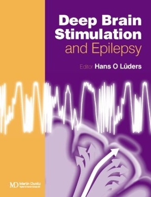 Deep Brain Stimulation and Epilepsy - Hans O. L&uuml;ders