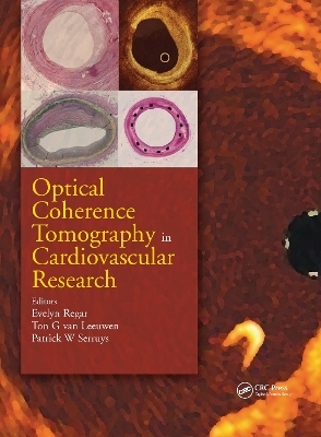 Optical Coherence Tomography in Cardiovascular Research - 