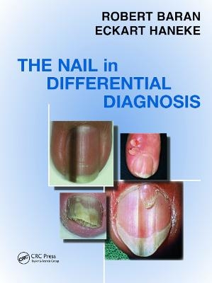 Nail in Differential Diagnosis - Robert Baran, Eckart Haneke