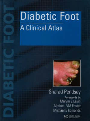 Diabetic Foot