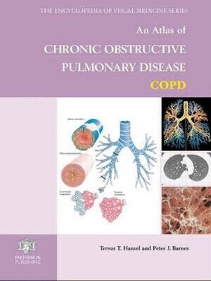 An Atlas of Chronic Obstructive Pulmonary Disease - Trevor T. Hansel, Peter J. Barnes