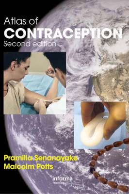 Atlas of Contraception - Pramilla Senanayake, Malcolm Potts