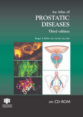 An Atlas of Prostatic Diseases CD-ROM