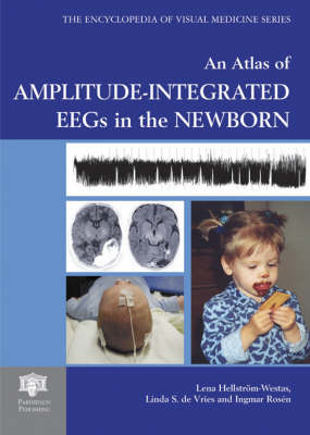 An Atlas of Amplitude-Integrated EEGs in the Newborn, Second Edition, with DVD - Lena Hellstr&ouml;m-Westas