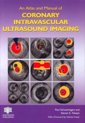 An Atlas and Manual of Coronary Intravascular Ultrasound Imaging - 