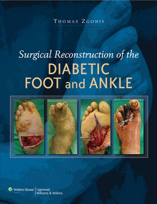 Surgical Reconstruction of the Diabetic Foot and Ankle -  Thomas Zgonis