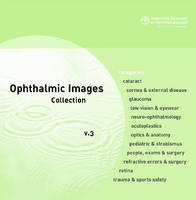 Ophthalmic Images
